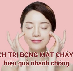 7 Cách trị bọng mắt chảy xệ hiệu quả nhanh chóng đừng bỏ qua
